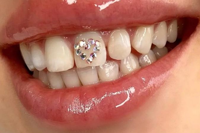 Teeth Jewels