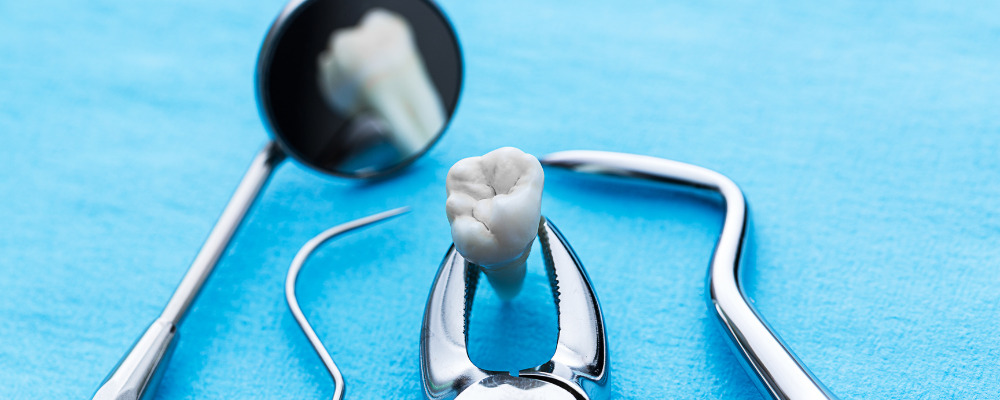 Preventive measures after wisdom tooth extraction