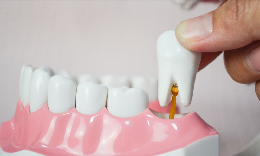 Is Wisdom tooth extraction always necessary?