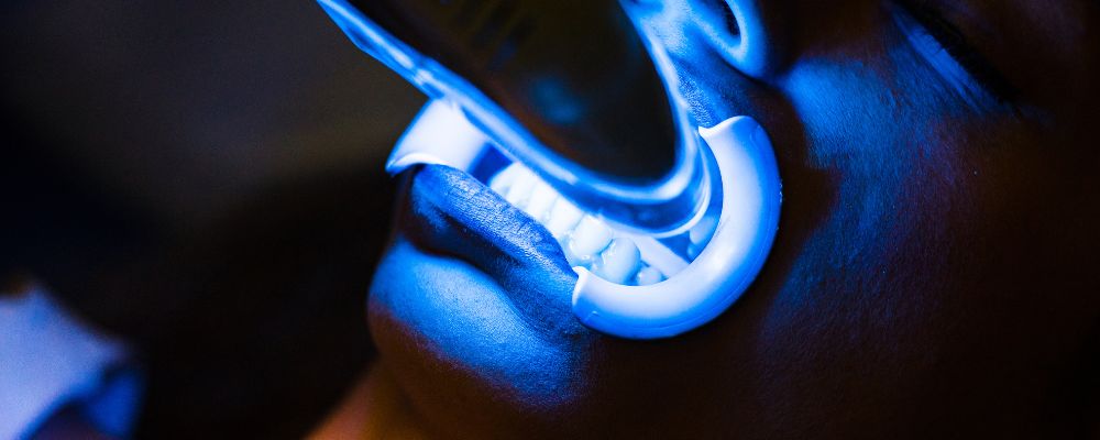 Zoom Teeth Whitening treatment with Philips