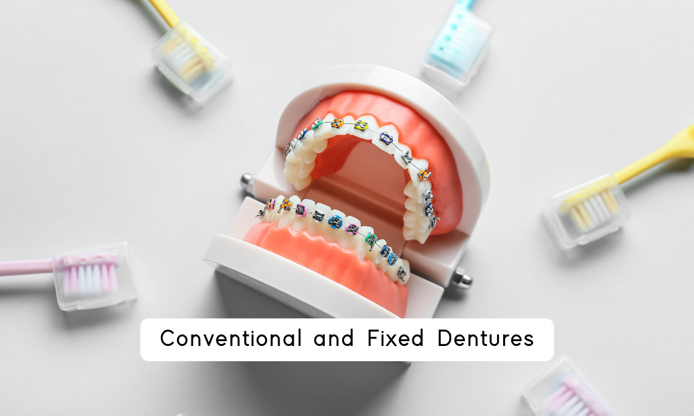 Conventional and Fixed Dentures