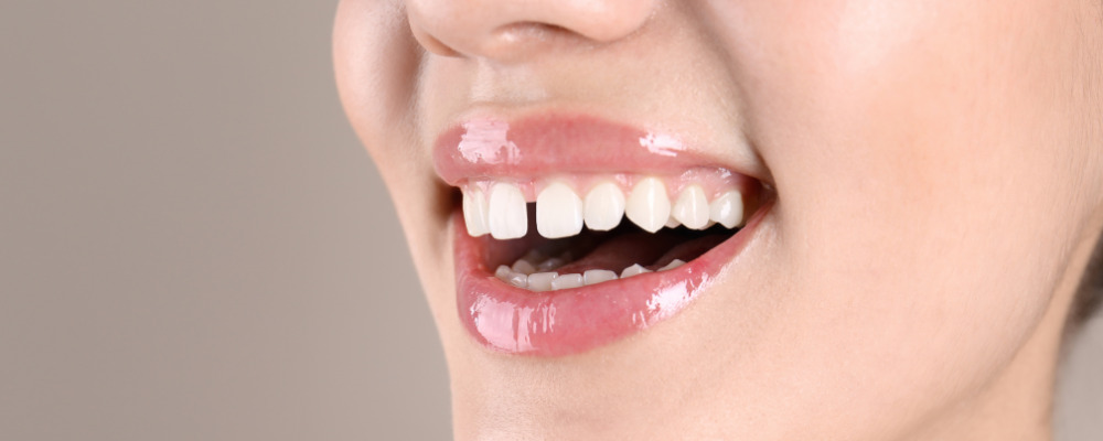 confident smile is seamless after having dentures