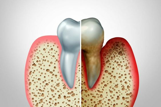 Periodontics