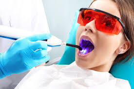 Laser Dentistry in Dilshad Garden