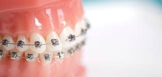 best Orthodontics in East Delhi