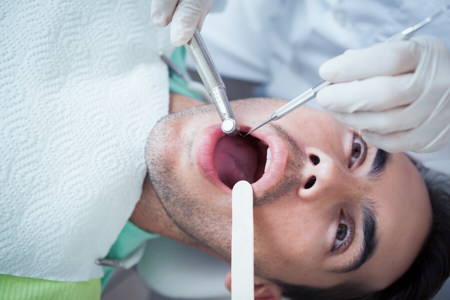 Best Periodontist Treatment in East Delhi: Your Guide to Healthy Gums and Teeth