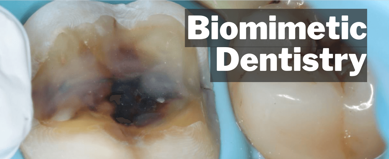 Best Biomimetic dentist in Delhi