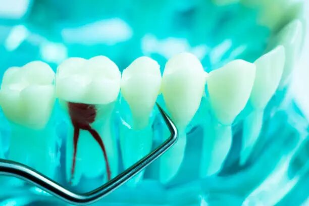 Best Periodontist Treatment in Shahdara