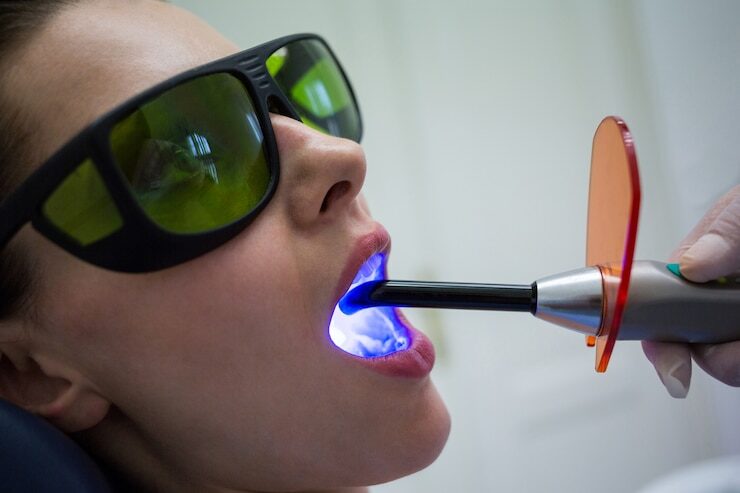Best Laser Dentist Treatment in East Delhi