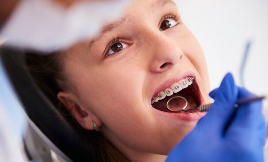Best Orthodontic Dental Treatment in Dilshad Garden