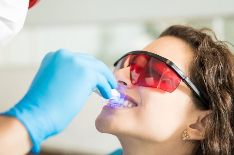 Best Teeth Whitening Treatment in Dilshad Garden