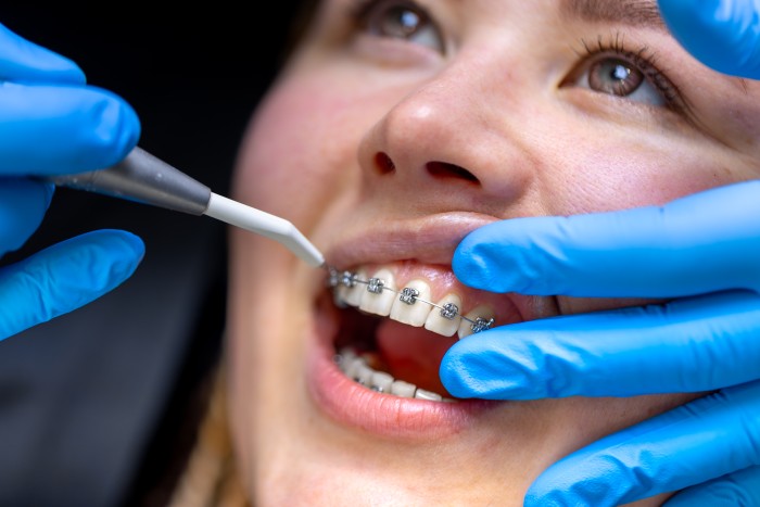 Best Orthodontic Dental Treatment in Karkardooma