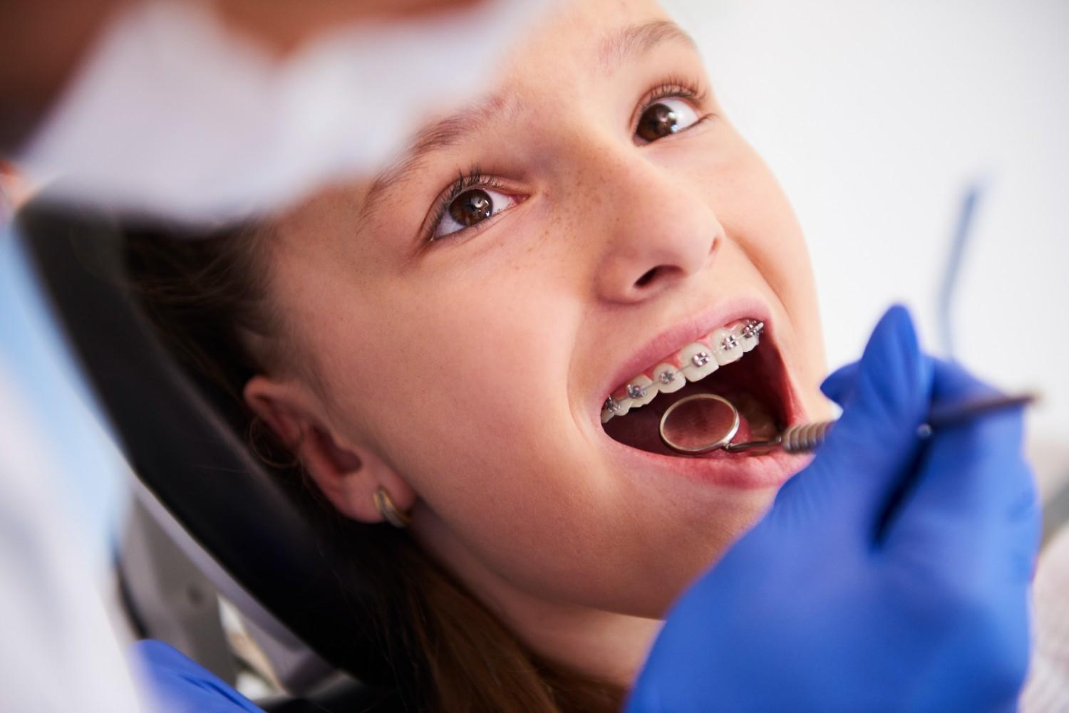Best Orthodontic Dental Doctor in Delhi