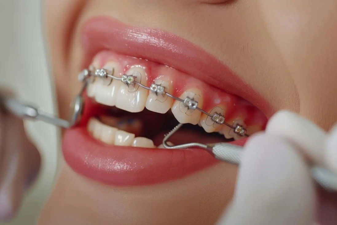 Best Orthodontic Dental clinic in Shalimar Garden