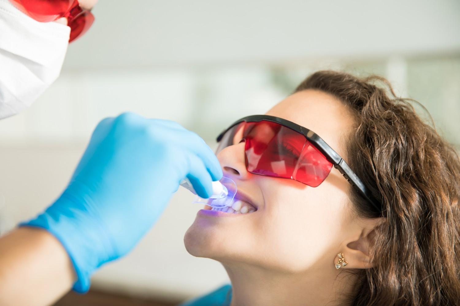 Best Teeth Whitening Treatment in Delhi