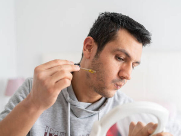 Man Applying Serum To His Balding Beard