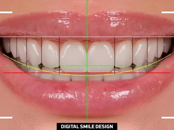 Digital Smilef