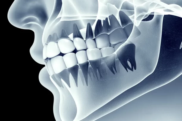 Jawbone